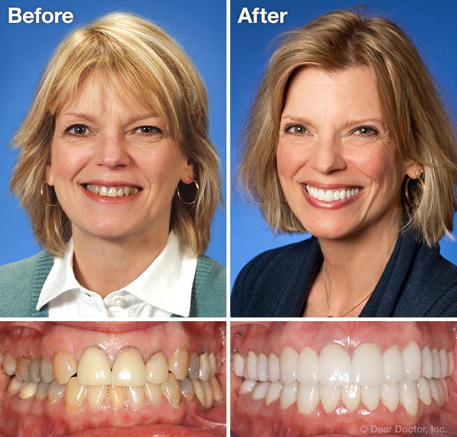 https://www.deardoctor.com/images/website-content/cosmetic-dentistry/cosmetic-dentistry-before-after-case.jpg
