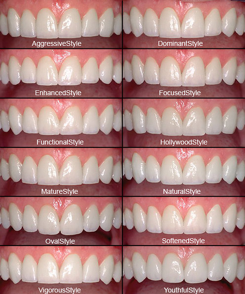 https://radfordfamilydental.com/wp-content/uploads/2020/03/smile-design.jpg