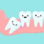 تاثیر کشیدن یا نکشیدن دندان عقل در ارتودنسی