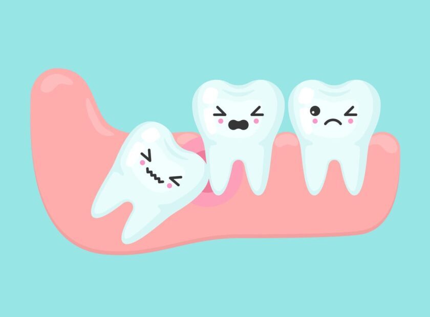 Wisdom tooth problems dental stomatology vector concept