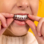 آیا حرکت دندان ها بعد از ارتودنسی طبیعی است؟