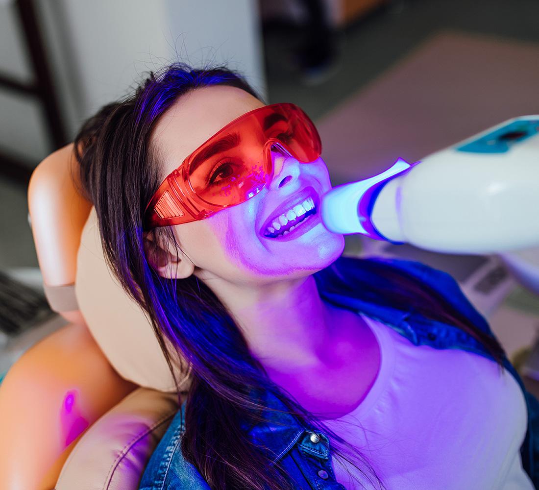 Teeth whitening for woman. Bleaching of the teeth at modern dent