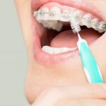مسواک بین دندانی چیست؟ نکات مهم در استفاده از مسواک بین دندانی