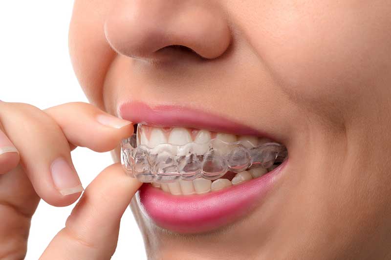 عوارض ارتودنسی
