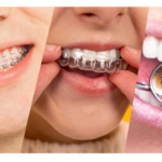 مسیر کامل درمان ارتودنسی در کلینیک دکتر عزیزلو؛ از اولین ویزیت تا برداشتن براکتها