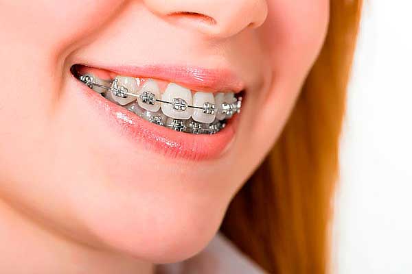 چرا به ارتودنسی نیاز داریم