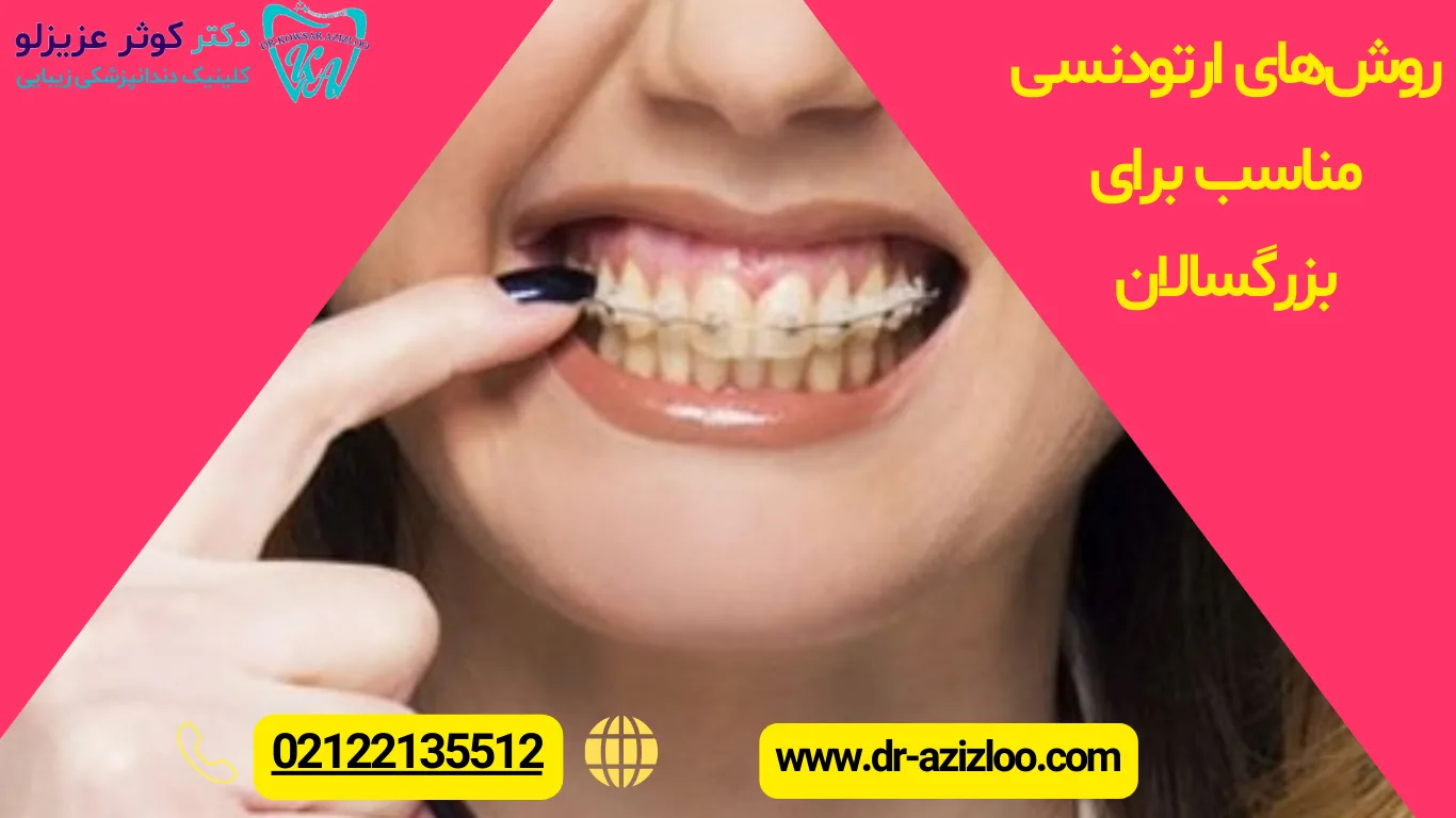 روشهای ارتودنسی مناسب برای بزرگسالان