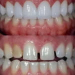 کلینیک تخصصی کامپوزیت دندان در سعادت‌آباد – لبخند رویایی شما