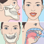 آیا همه افراد کاندیدای مناسبی برای درمان فاصله دندان بدون ارتودنسی هستند؟