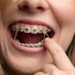 مدت زمان لازم برای درمان ارتودنسی چقدر است؟ عوامل موثر و جدول زمانی